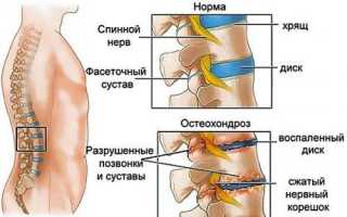 Копчиковые позвонки