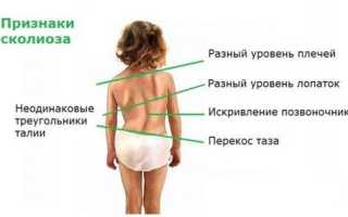 Проверка осанки в домашних условиях