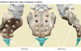 Боль в аноректальной области, боль копчике