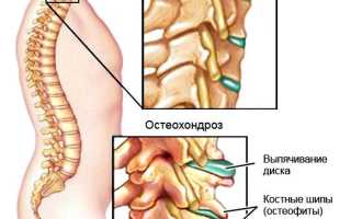 Массаж шиацу