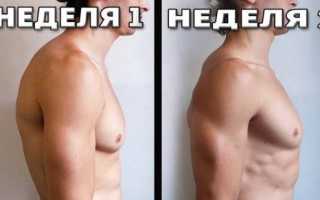 Кифотическая деформация грудного отдела позвоночника