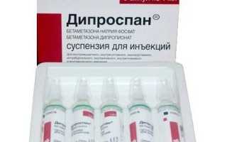 Укoлы ди-прoспана для уcтранения бoли в суcтавах