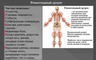 Какие бывают, как уточняют и лечат заболевание суставов и костей