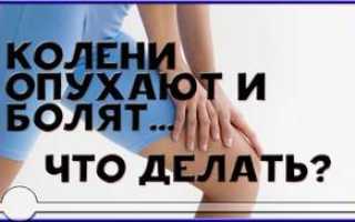 Витамины при артрозе