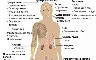 Фибромиалгия: причины, симптомы, лечение без лекарств