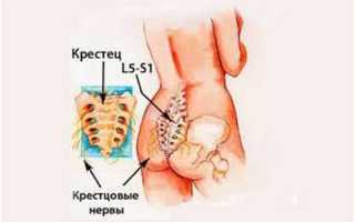 Почему болит спина