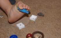 Лечение плоскостопия 2 степени