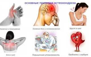 Как избавиться от хруста в шее